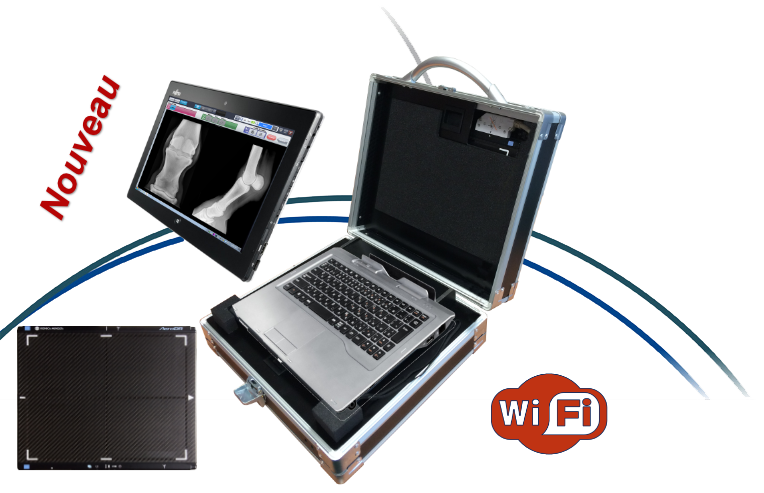 AeroVet Mobile Capteur Plan wifi